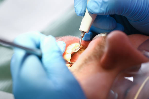 Best Emergency Gum Treatment in Tye, TX