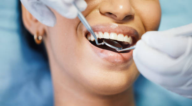 Best Emergency Wisdom Teeth Removal in Tye, TX